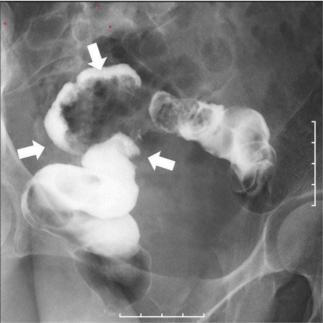 Fig. 1