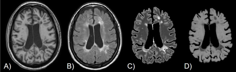 Figure 4