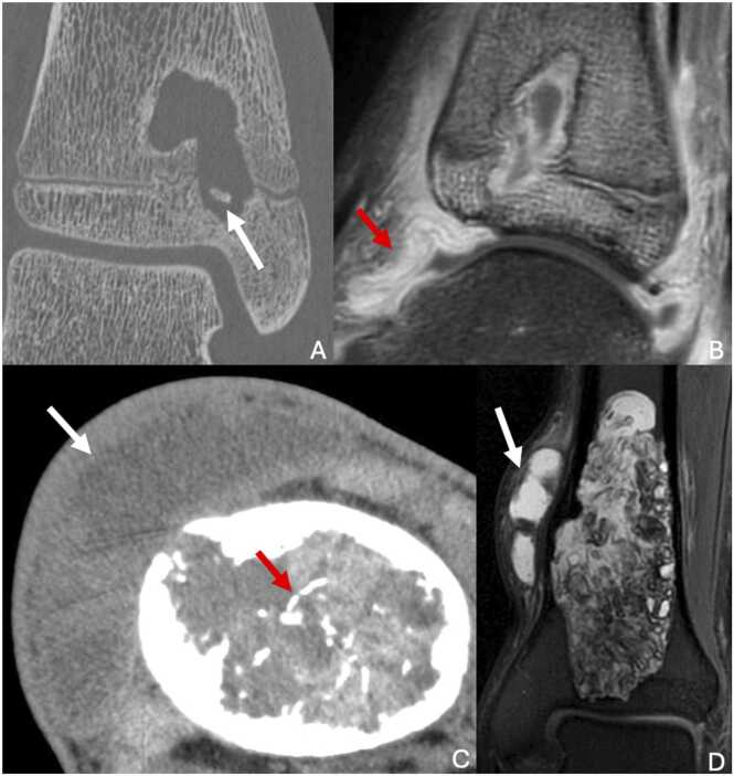 Figure 14