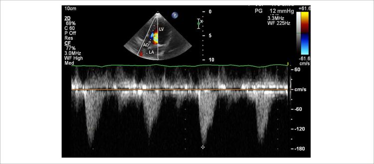 Figure 13