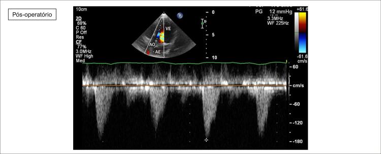 Figure 14