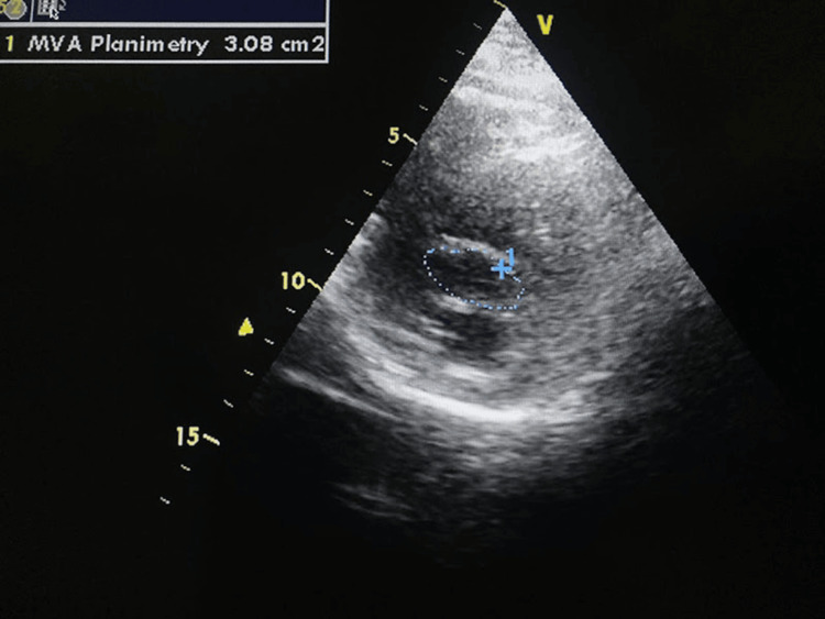 Figure 5