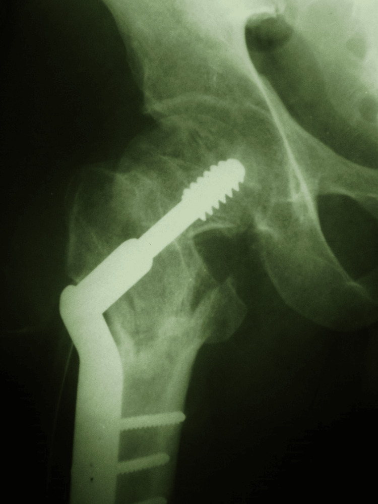 Figure 9