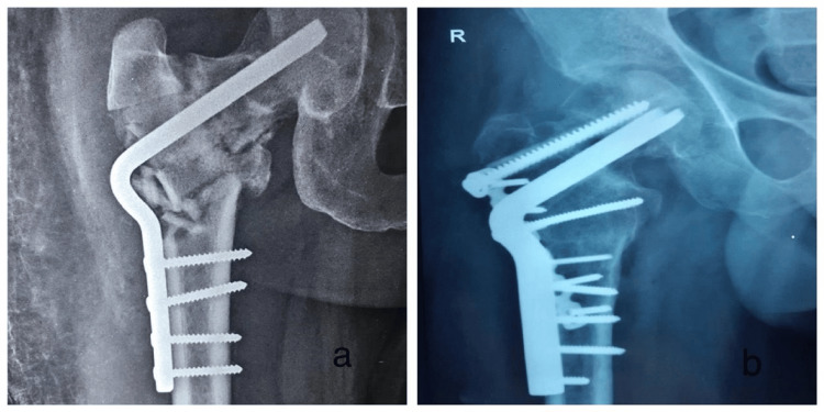 Figure 10