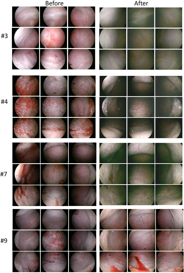 Fig 3