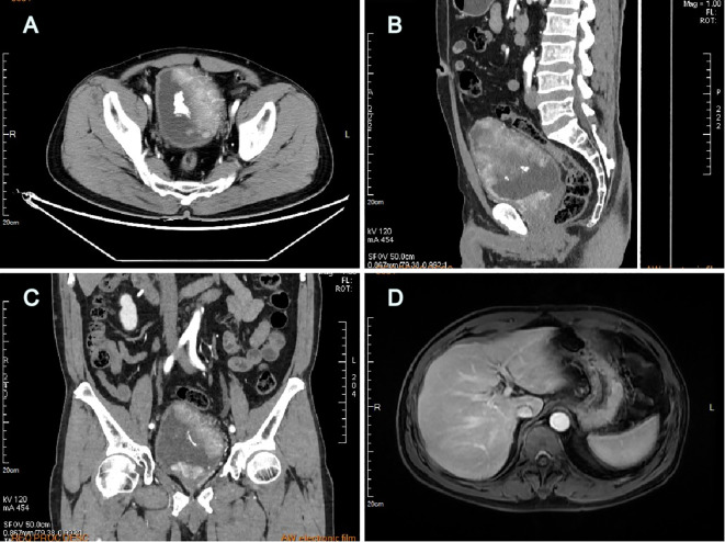 Figure 1