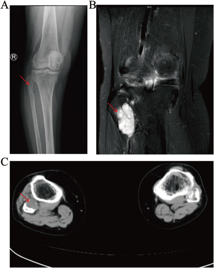 Figure 1