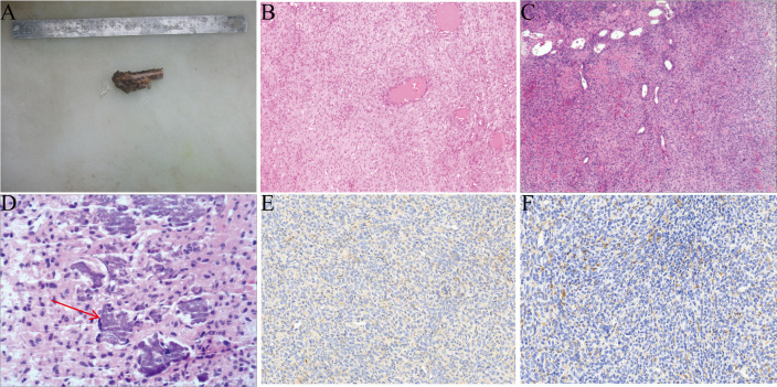 Figure 3