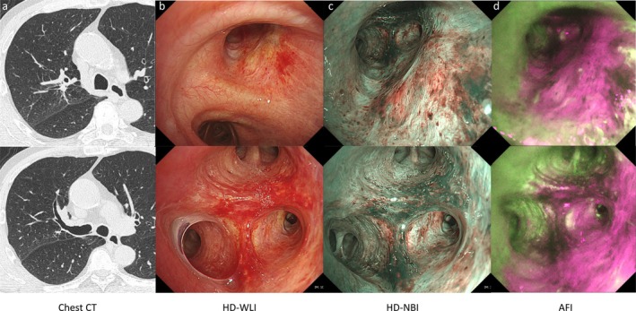 FIGURE 2