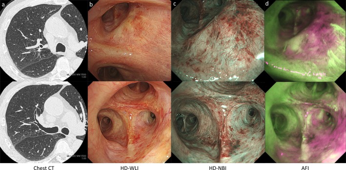 FIGURE 3