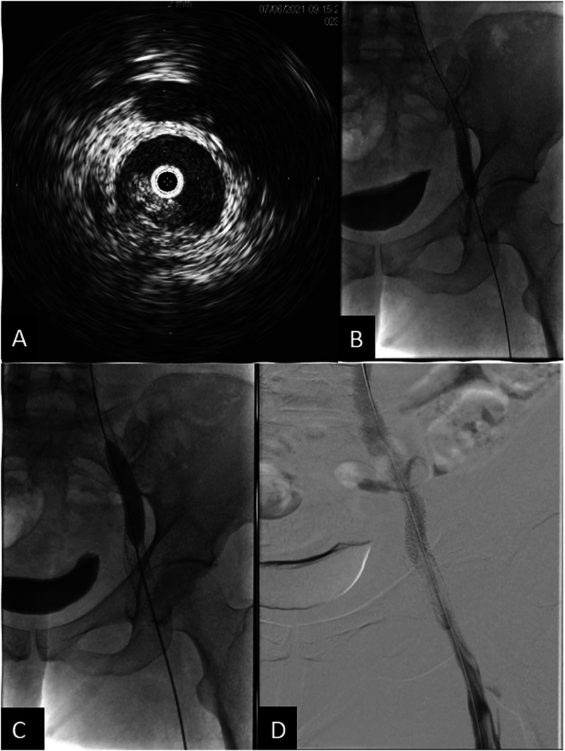 Figure 4