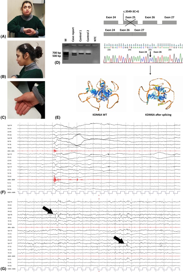 FIGURE 1