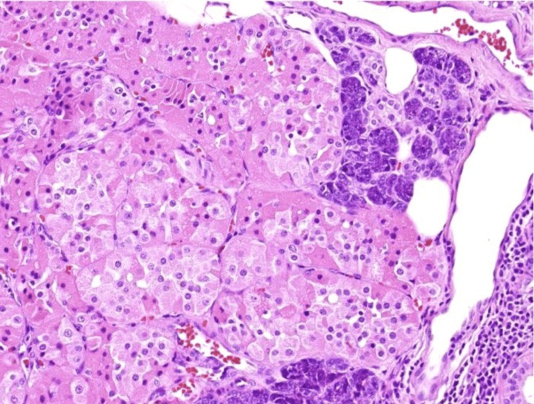 Figure 11