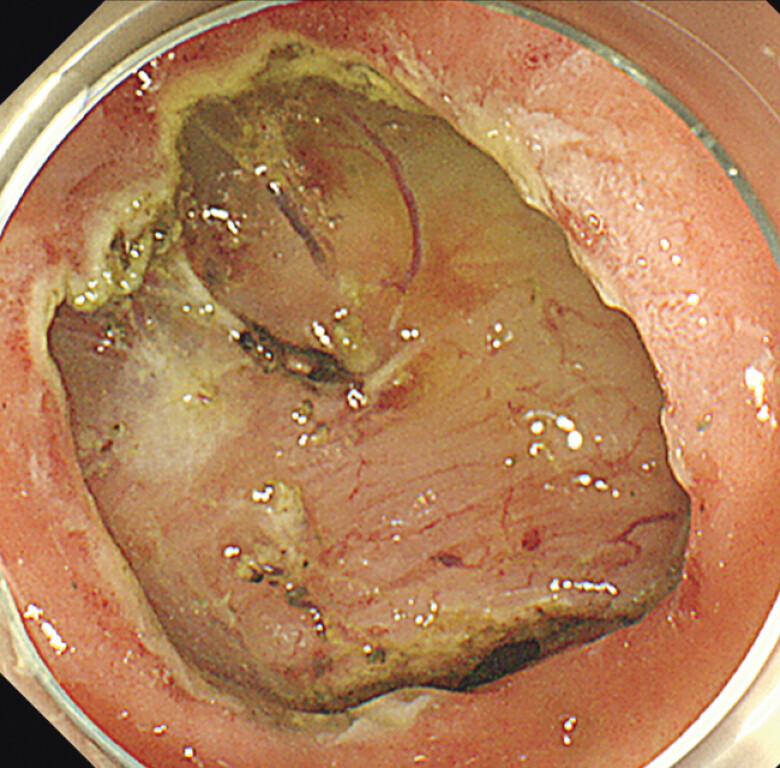 Fig. 4