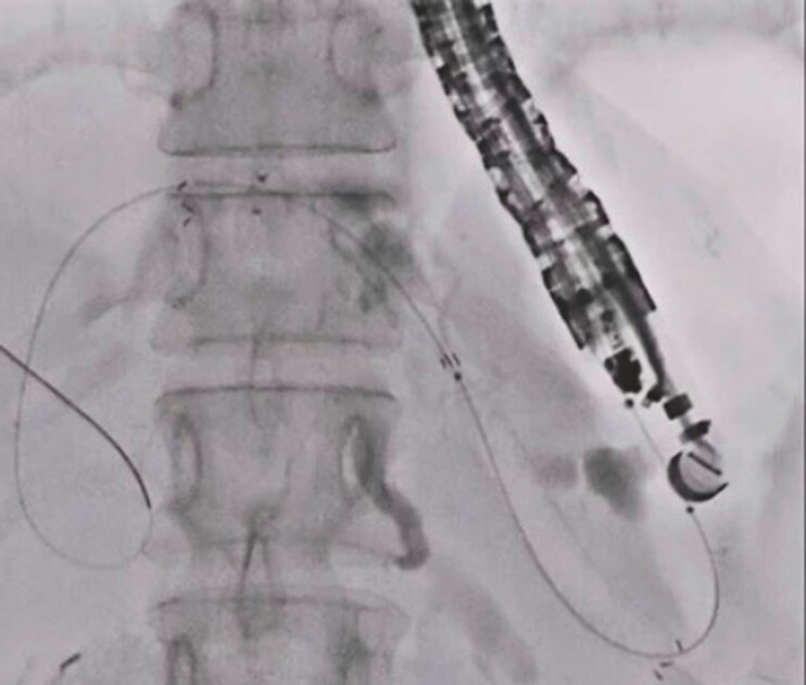 Fig. 2