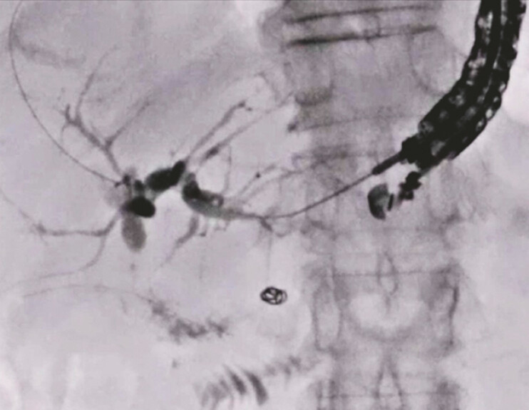 Fig. 4