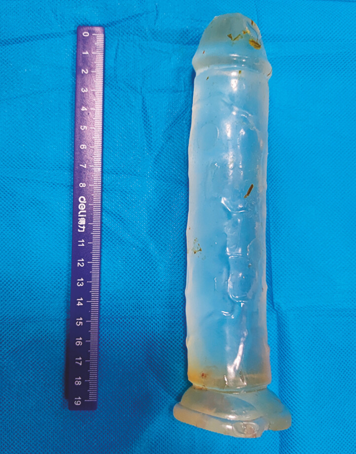 Fig. 3