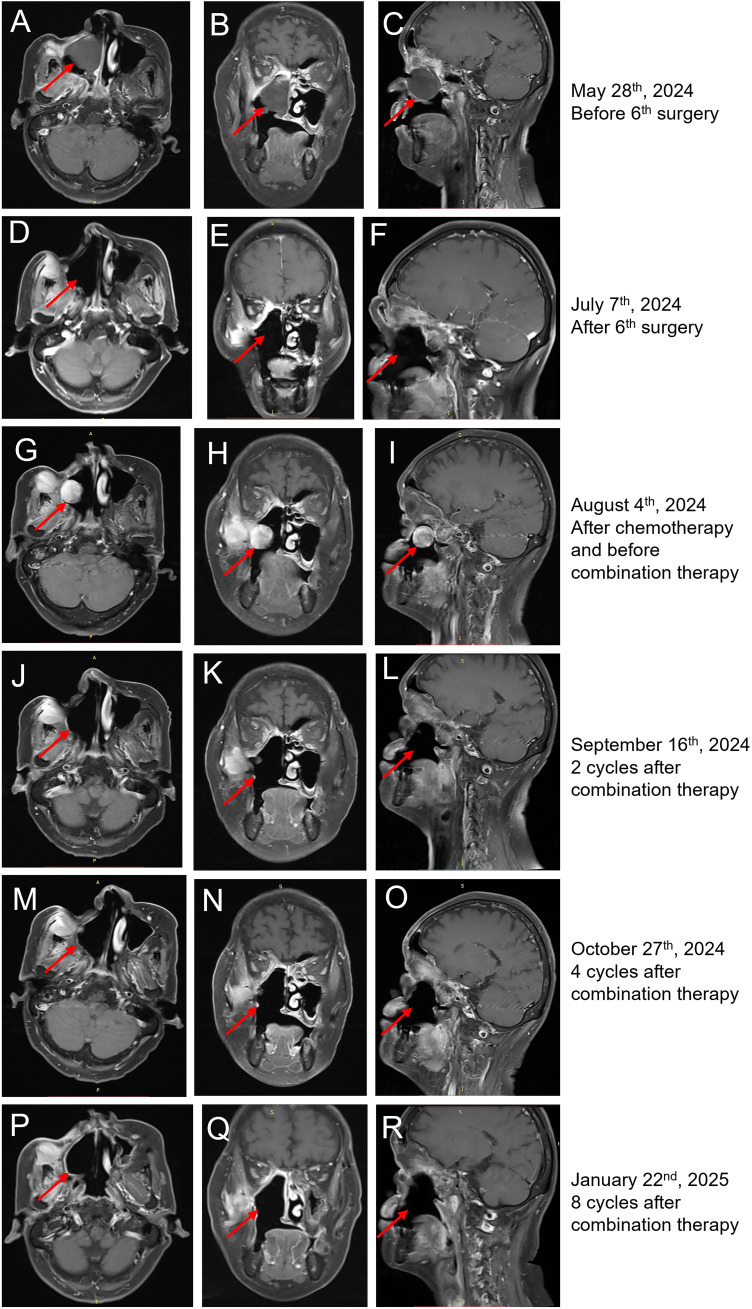 Figure 3