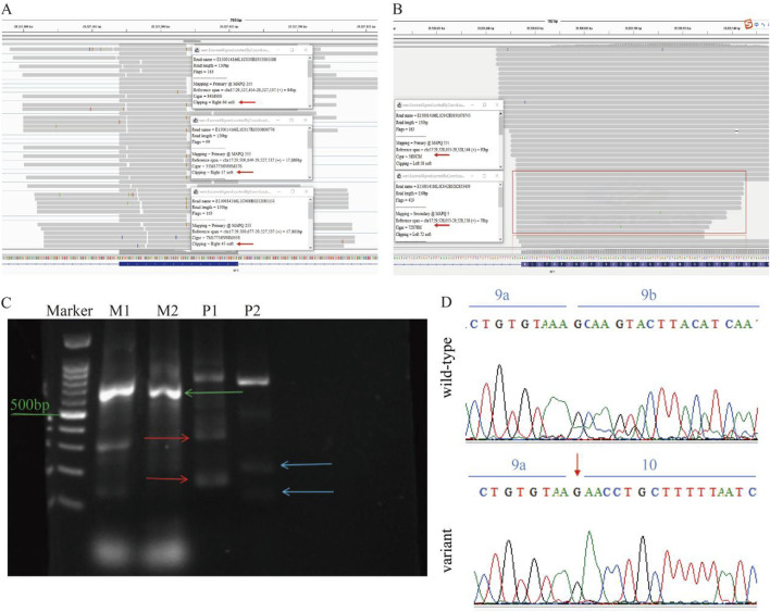 FIGURE 3