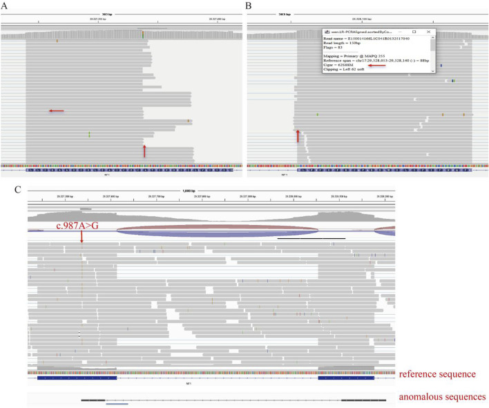 FIGURE 4