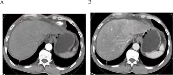 FIGURE 1