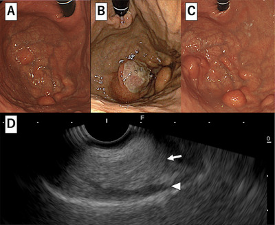 FIGURE 1