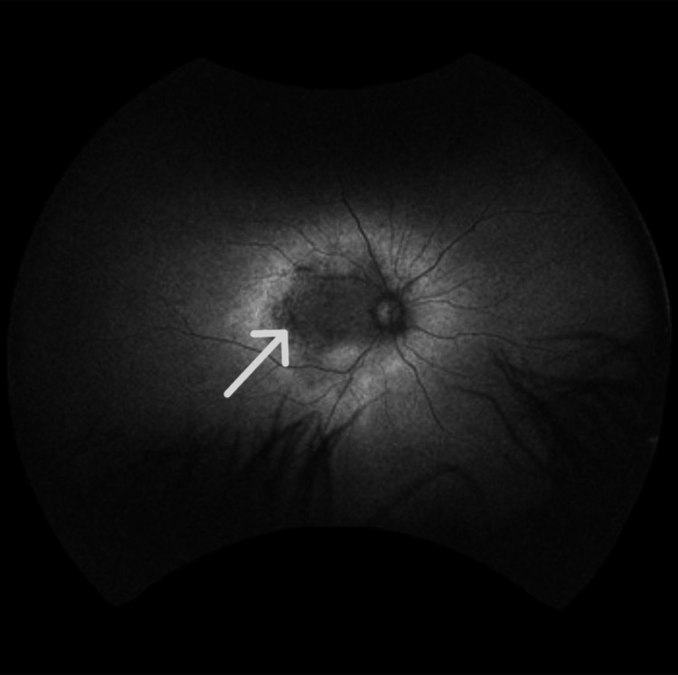 Figure 9