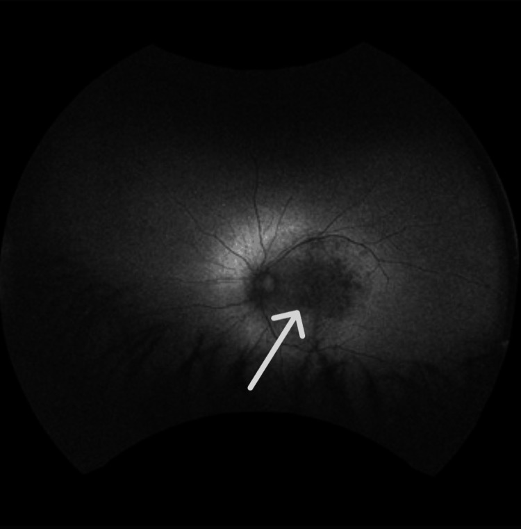 Figure 10