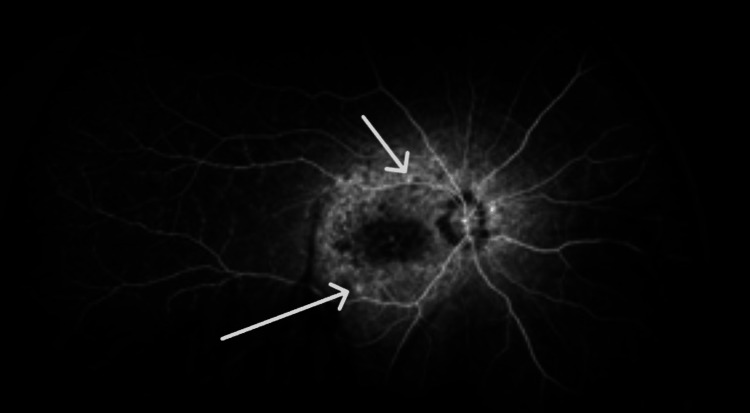 Figure 11