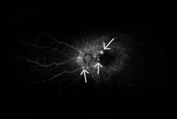 Figure 12