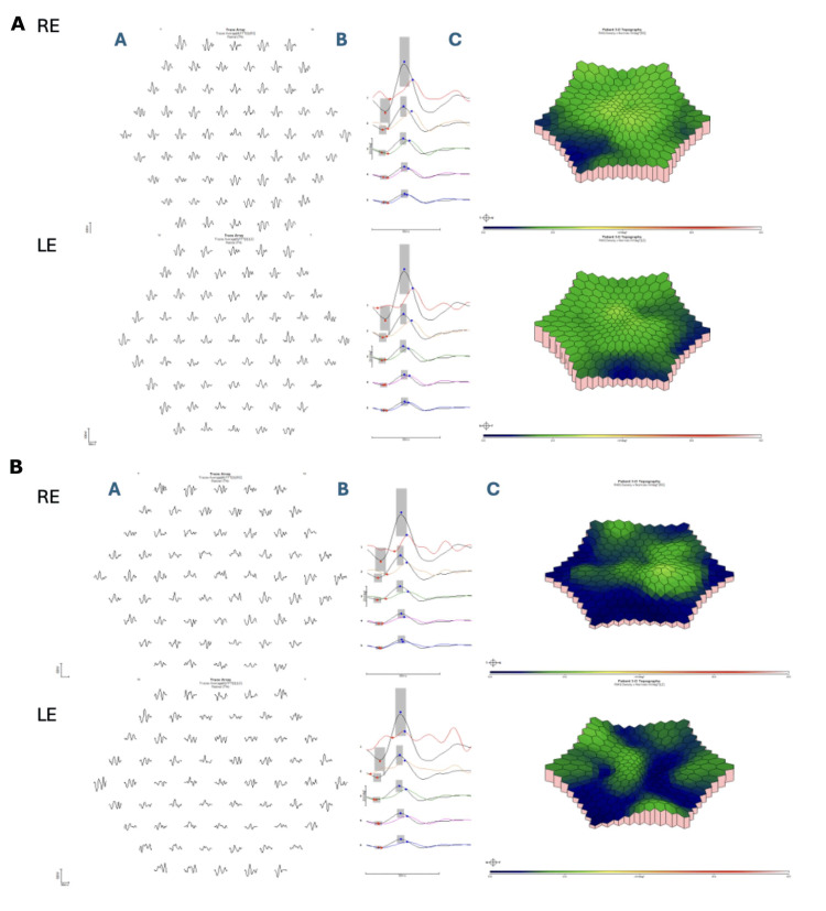 Figure 4