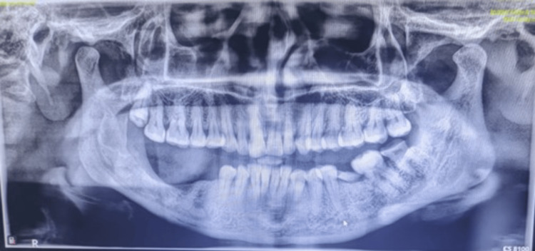 Figure 10