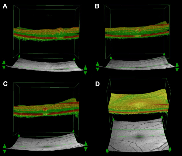 Figure 3