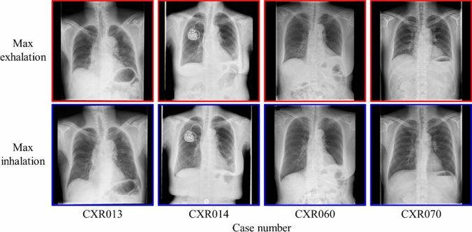 Figure 13