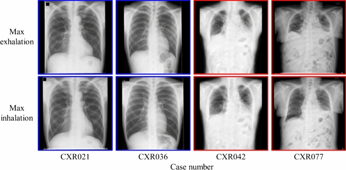 Figure 14