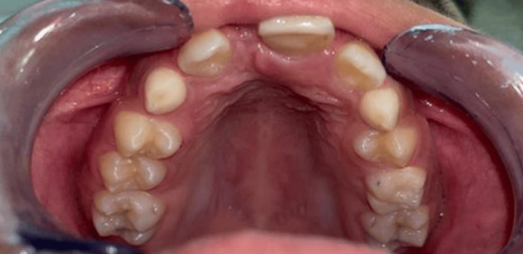 Figure 9