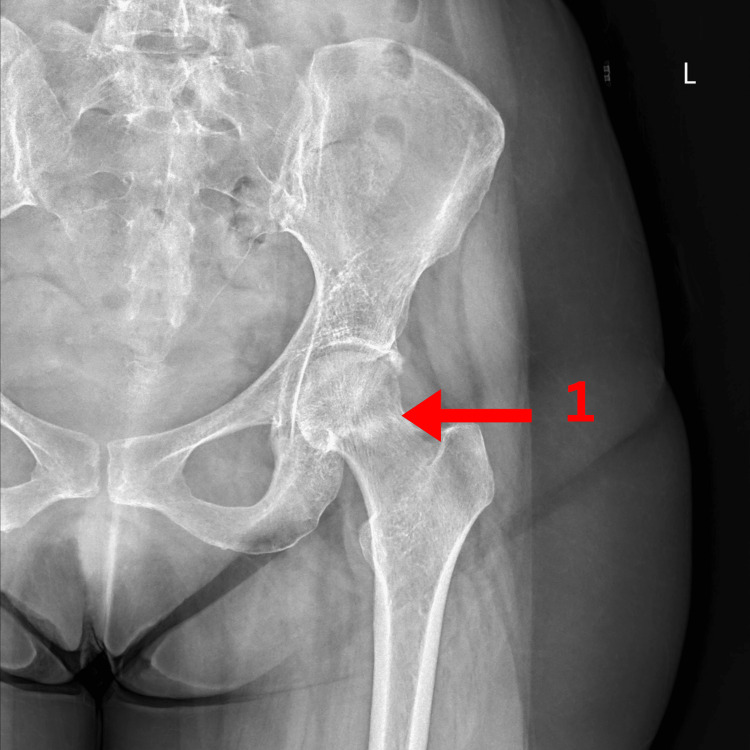 Figure 5