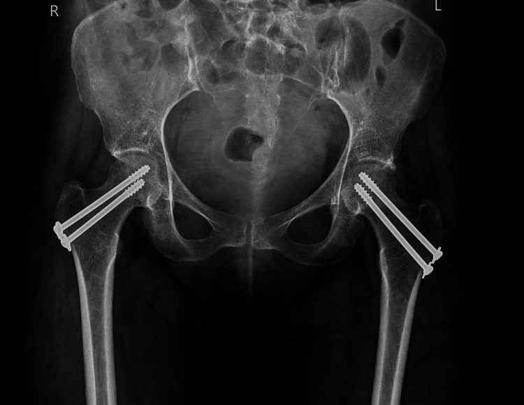 Figure 6