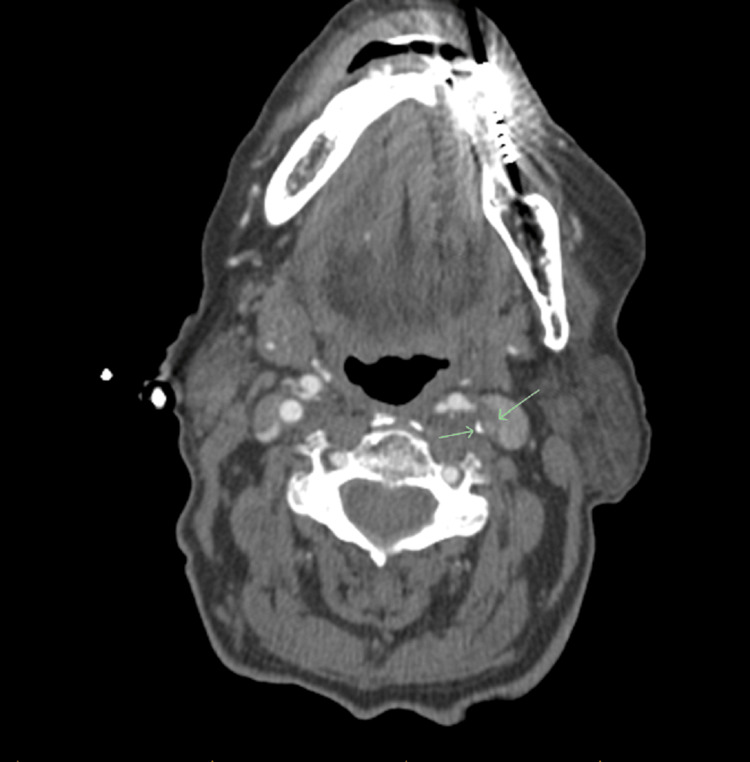 Figure 2