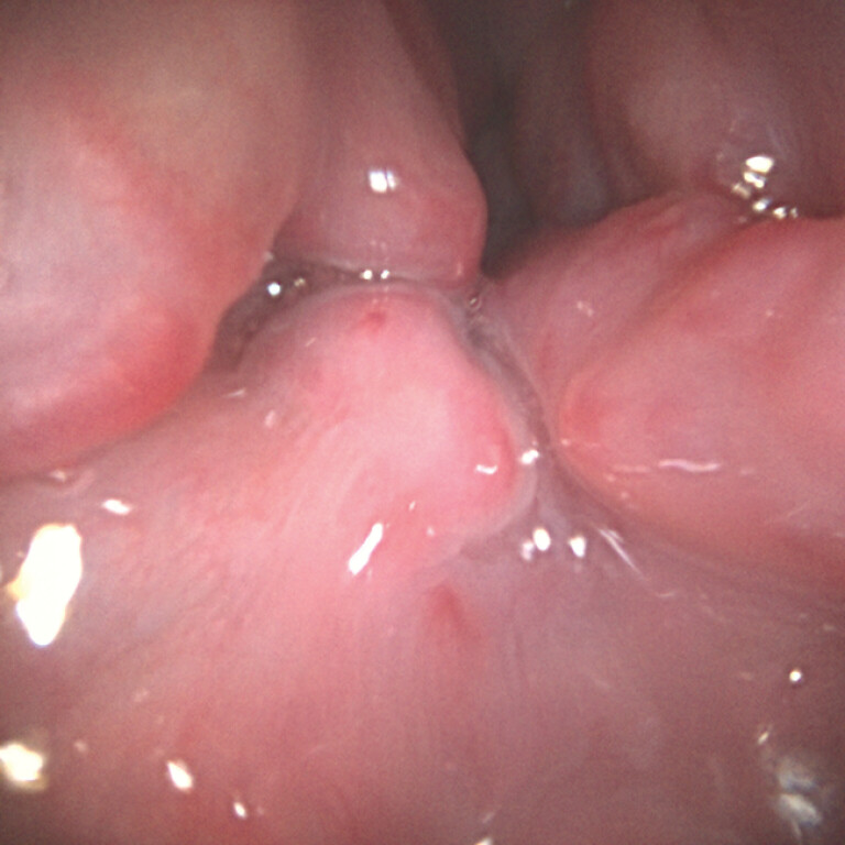 Fig. 3