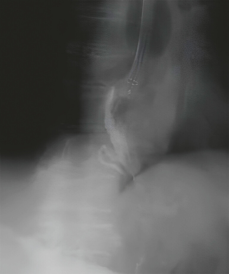 Fig. 5