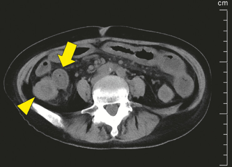 Fig. 3