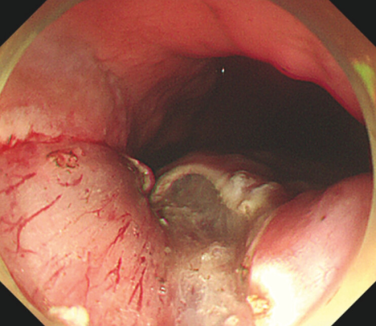 Fig. 2