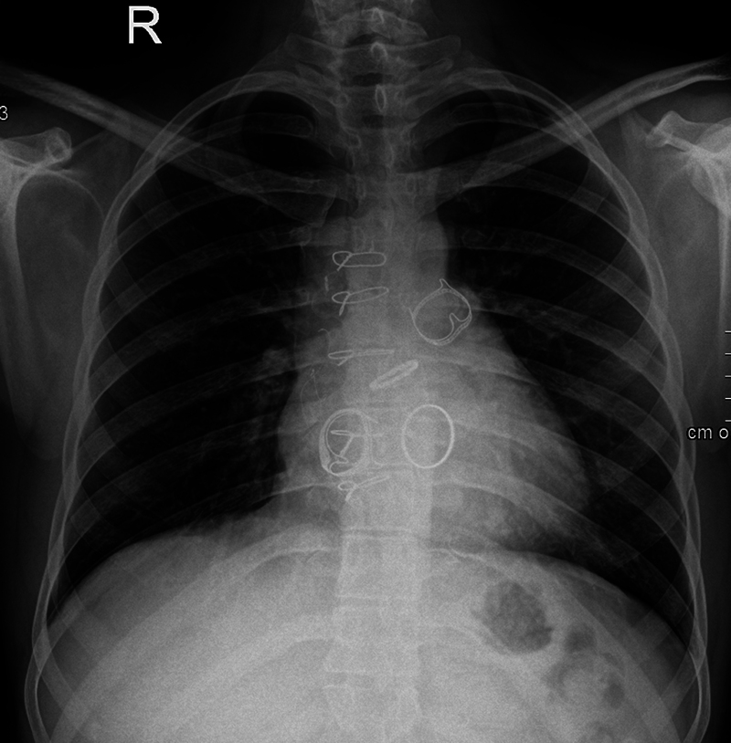 Fig. 1