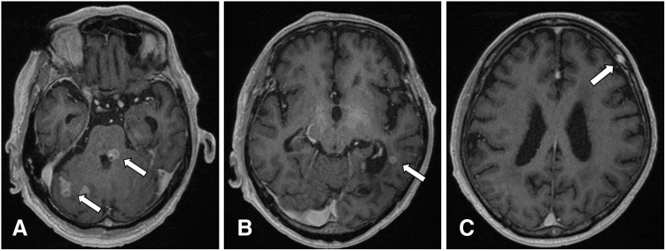 Fig. 5