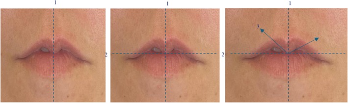 FIGURE 3
