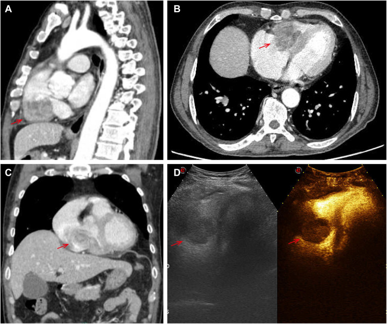 Figure 1
