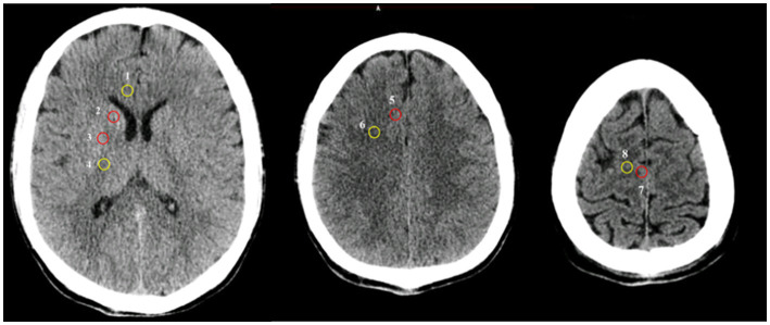 Figure 2