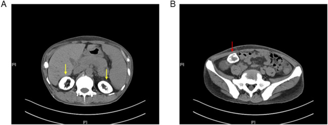 FIGURE 2