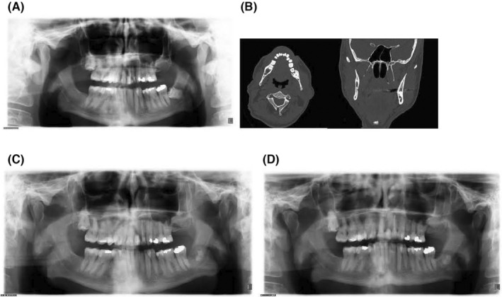 FIGURE 2